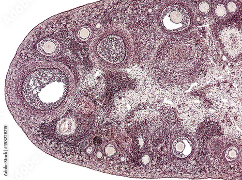Ovary (cross section) showing histology and maturation of follicle. Developing follicle. Follicular cells, granulosa cells, oogenesis.  Hematoxylin and eosin stain (H&E).  photo