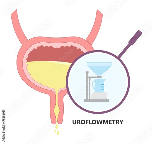 urination study test urine leak EMG Urethral flow often tract exam diagnose diagnostic therapy bio feedback kidney pelvic muscle floor weak organ pain urge toilet enlargement stress outlet cancer