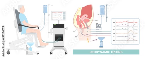 urination study test urine leak EMG Urethral flow often tract exam diagnose diagnostic therapy bio feedback kidney pelvic muscle floor weak organ pain urge toilet enlargement stress outlet cancer