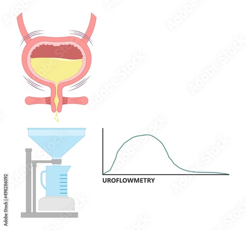 urination study test urine leak EMG Urethral flow often tract exam diagnose diagnostic therapy bio feedback kidney pelvic muscle floor weak organ pain urge toilet enlargement stress outlet cancer