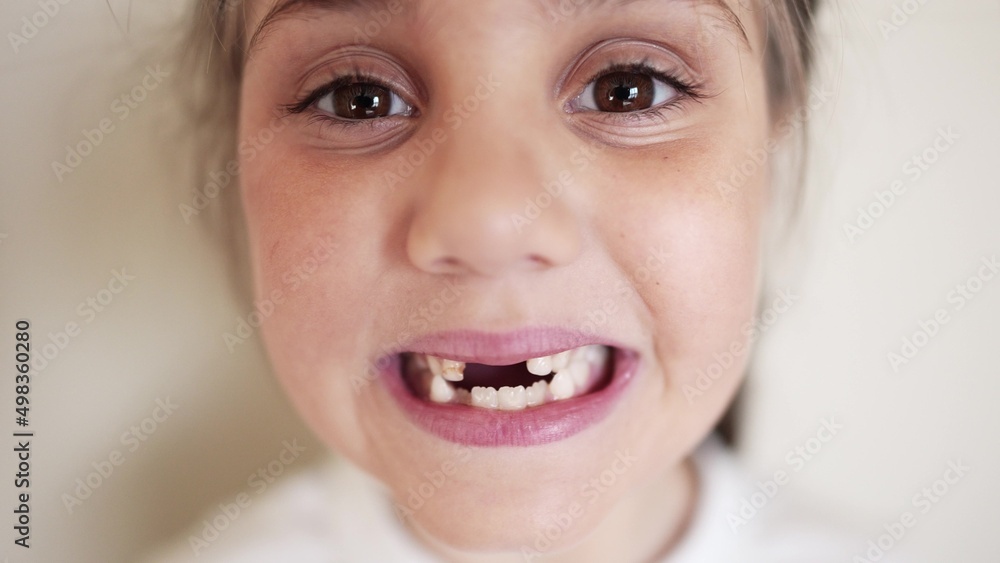 baby no teeth. child smiling no milk a teeth fell out. medicine dentistry happy end family. girl kid close-up smile without teeth. lifestyle daughter without front teeth portrait baby no teeth. child smiling no milk a teeth fell out. medicine dentistry happy end family. girl kid close-up smile without teeth. lifestyle daughter without front teeth portrait