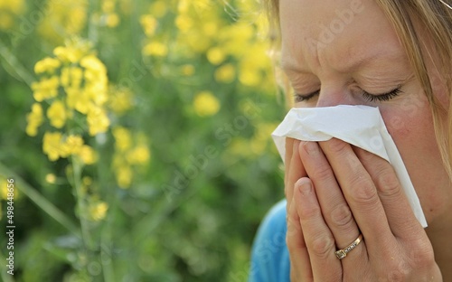 woman with allergy sneezing because of pollen blowing her nose with  yellow flower background stock photo