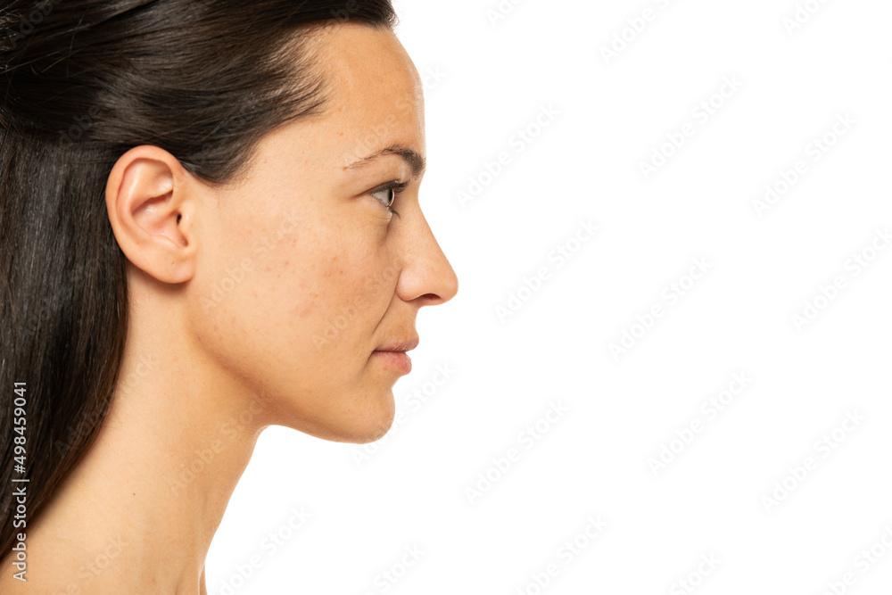 Profile, side view portrait of a beautiful serious woman without makeup on a white background Profile, side view portrait of a beautiful serious woman without makeup on a white background