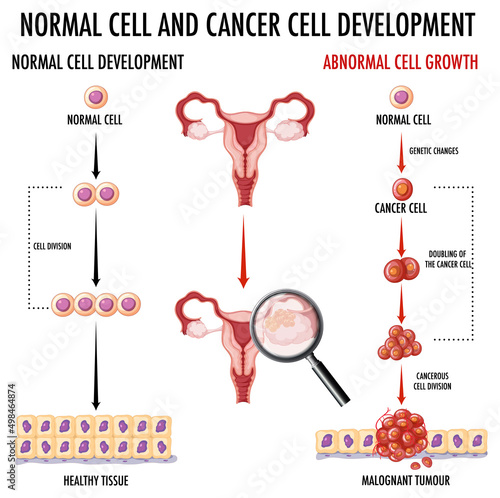 Diagram showing normal and cancer cells in human