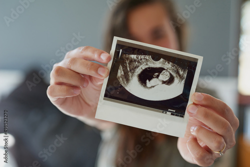 Look at my little peanut. Shot of a woman holding a sonogram of her unborn baby. photo