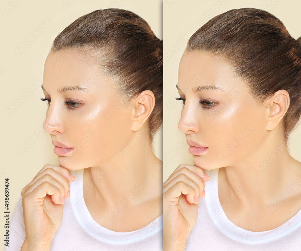 Alopecia Areata,female pattern baldness,Treatment for hair loss,Hair transplant,Surgery to implant artificial hairs Alopecia Areata,female pattern baldness,Treatment for hair loss,Hair transplant,Surgery to implant artificial hairs