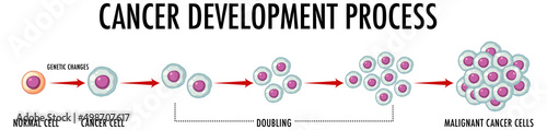 Cancer development process infographic