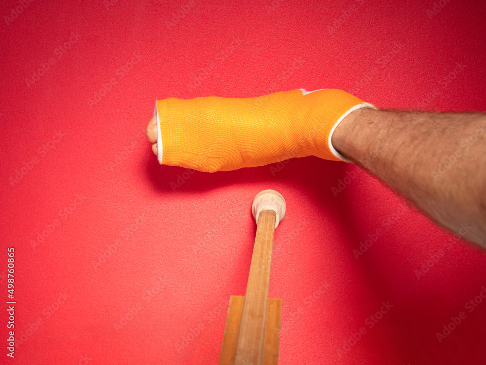 Foot with broken toe bone in orange fiberglass cast pink background