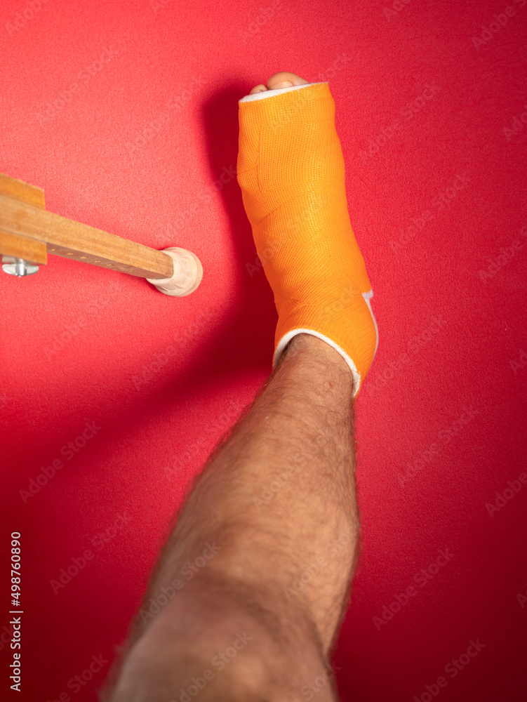 Foot with broken toe bone in orange fiberglass cast pink background