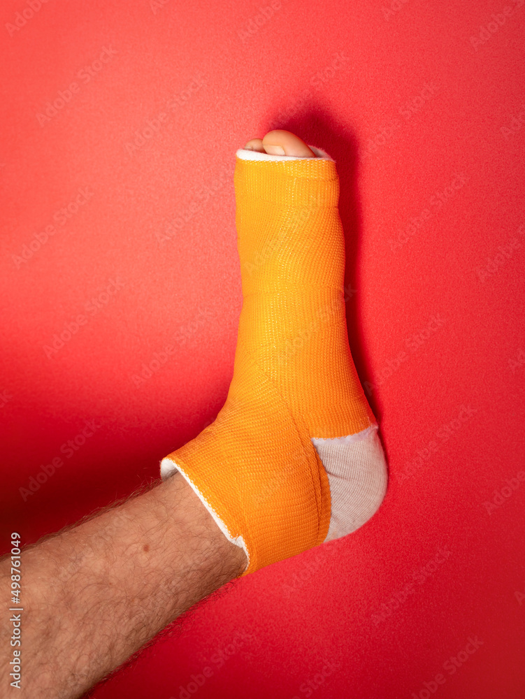 Foot with broken toe bone in orange fiberglass cast pink background