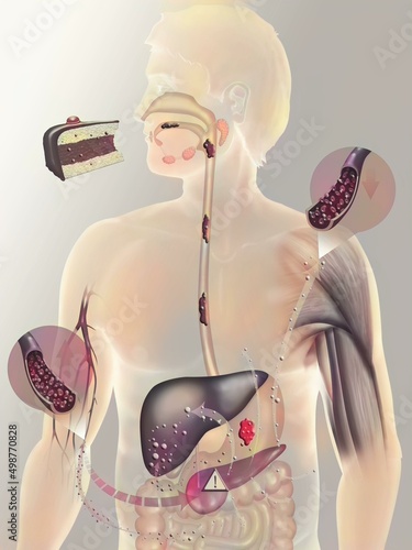 Secretion of insulin on a person with diabetes type 2.