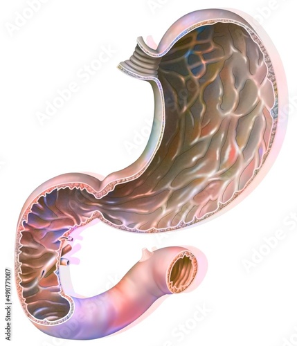 Section of the stomach and duodenum with the gastric mucosa.