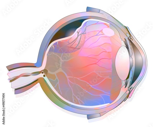 Eye: detachment of the retina. photo