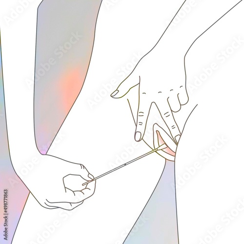 Introduction of the dry swab into the vagina (vaginal self-sampling).