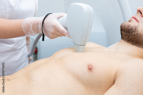 Laser hair removal for men's chest