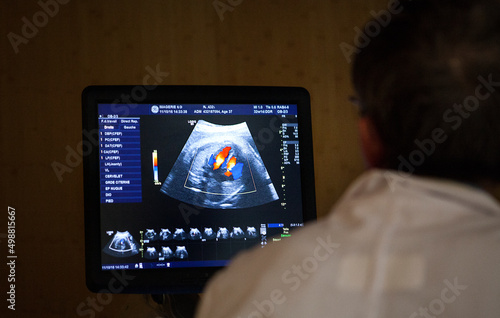 A doctor radiologist performs an ultrasound of the third trimester. photo