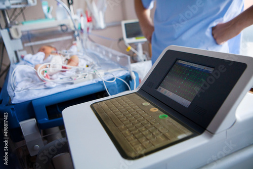 A premature newborn with abnormal heart rhythms has an ECG.