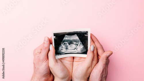 Photo Ultrasound image pregnant baby photo