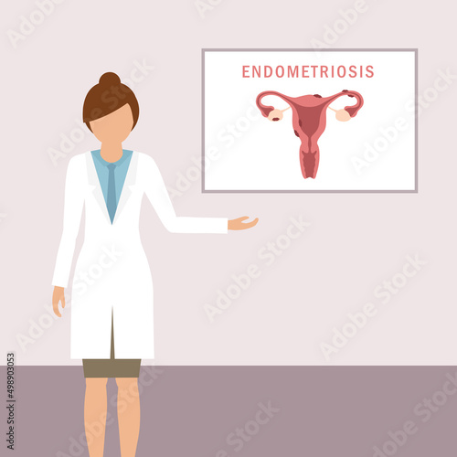 female doctor is speeking about endometriosis womens health anatomy info graphic