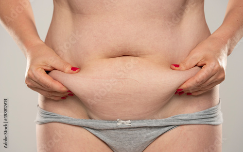 Woman pinching her fat belly, isolated on white.