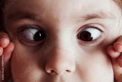 Eyes with squinted look and eyebrows on male face. Female eyes with strabismus. Hypertropia. Woman eyes suffering from strabismus - close up