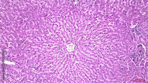 Photos Light micrograph of a human liver stained with hematoxylin and eosin