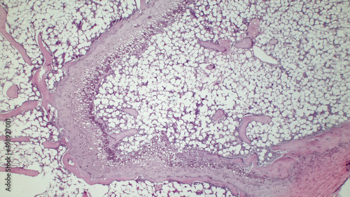 Light micrograph of red bone marrow, showing active haemopoietic tissue (purple, pink) and adipocytes (white spaces). Hematoxylin and eosin stain. 