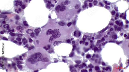 Light micrograph of a section through red bone marrow tissue. It consists mainly of haematopoietic tissue, where blood cells are created. In the center are three megakaryocytes. photo