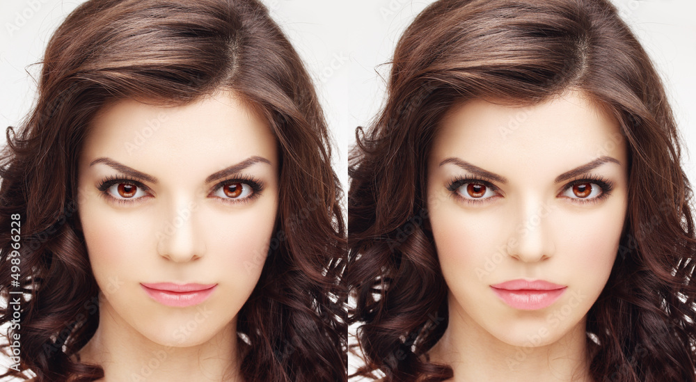 Beauty injections.Concept of rejuvenation.Lip augmentation Beauty injections.Concept of rejuvenation.Lip augmentation