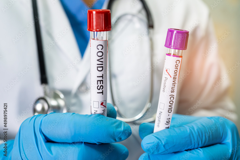 Positive blood infection sample in test tube for omicron covid19 coronavirus in lab. Scientist holding to check and analyze for patient in hospital. Positive blood infection sample in test tube for omicron covid19 coronavirus in lab. Scientist holding to check and analyze for patient in hospital.