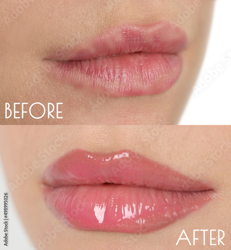 Collage with photos of young woman before and after permanent lip makeup, closeup photo