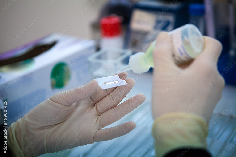 Manufacture of therapeutic vaccines for the treatment of small cell. Manufacture of therapeutic vaccines for the treatment of small cell.