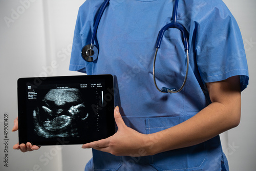 Obraz na plátně Female doctor holding a screen with fetal ultrasound.
