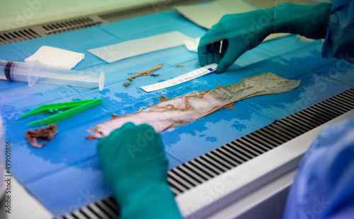 Photos Preparation of skin samples for skin grafting.