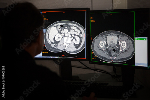 Doctor analyzing a CT scan of the abdomen in a hospital radiology.