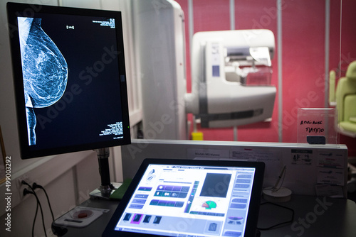 Mammogram in a radiology department of a hospital. photo