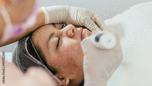 Unrecognizable doctor performing dermatological treatment on a patient.