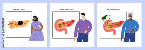 Pancreas disease and cancer