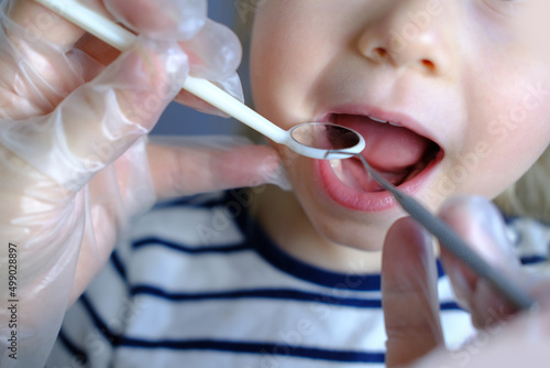 dentist, doctor examines oral cavity of small patient, uses mouth mirror, closeup baby teeth child, concept pediatric dentistry, dental treatment, correction of occlusion, oral care, caries prevention