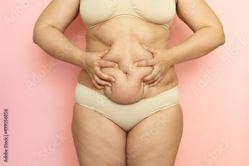 Foto Squeeze woman sagging belly closeup, folds on tummy, loose skin and cellulite, obesity