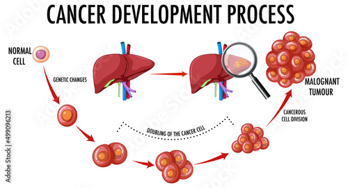 Diagram showing cancer development process
