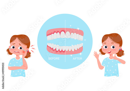 The concept of periodontitis treatment.  Periodontitis illustration. Crying girl with pain before treatment and happy after treatment. Under magnifying glass, diseased gums and healthy gums.Vector