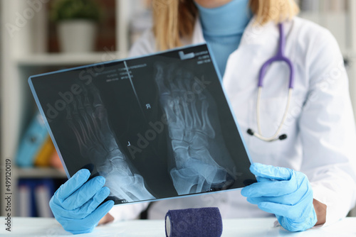 Doctor traumatologist examines x-ray of feet closeup photo