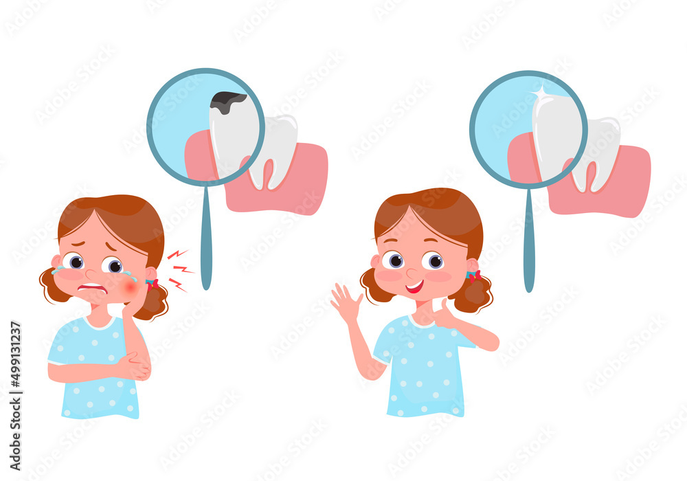 The concept of dental caries treatment. Crying girl with pain before treatment and happy after treatment. Under magnifying glass tooth with caries and healthy tooth. Vector illustration The concept of dental caries treatment. Crying girl with pain before treatment and happy after treatment. Under magnifying glass tooth with caries and healthy tooth. Vector illustration