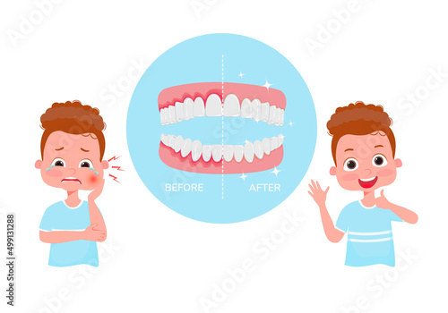 The concept of periodontitis treatment. Periodontitis illustration. Crying boy with pain before treatment and happy after treatment. Under magnifying glass, diseased gums and healthy gums. Vector