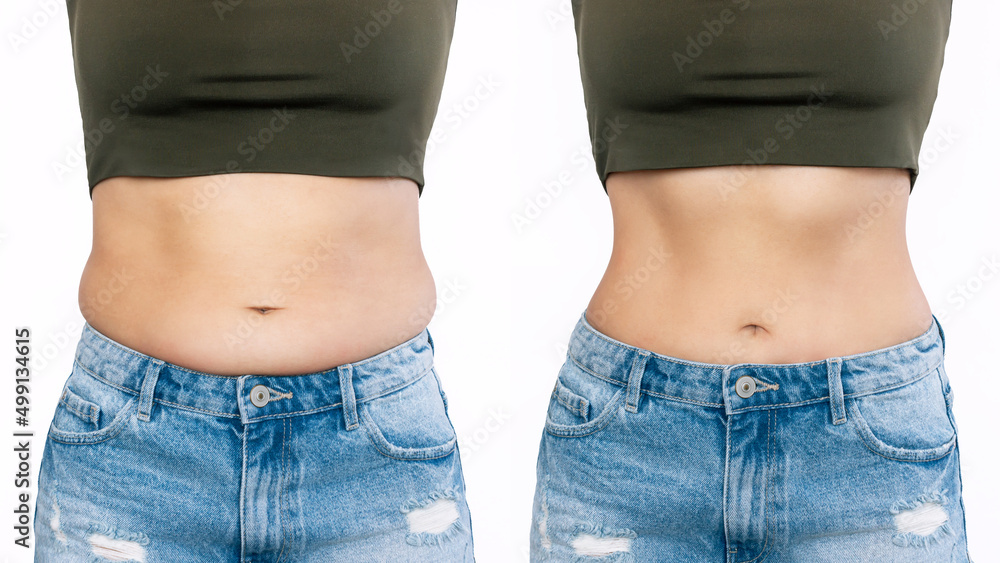 Two shots of a woman's belly with excess fat and toned slim stomach  before and after losing weight isolated on a white background. Result of diet, liposuction, training. Healthy lifestyle - obrazy, fototapety, plakaty 