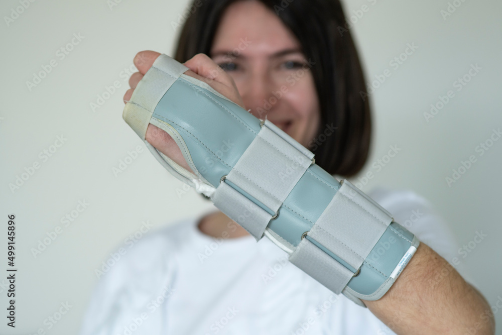 Young smiling cute girl wearing arm brace to heal fractures. Stock Photo Adobe Stock
