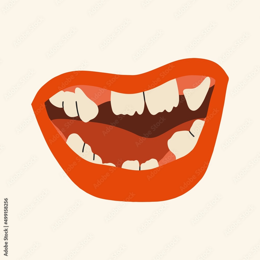 Mouth with crooked teeth. Curve dental problem, health care and dentistry hygiene concepts. Mouth with crooked teeth. Curve dental problem, health care and dentistry hygiene concepts.
