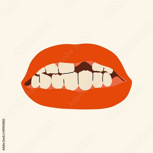 Mouth without one tooth. Flat design, hand drawn cartoon, vector illustration.
