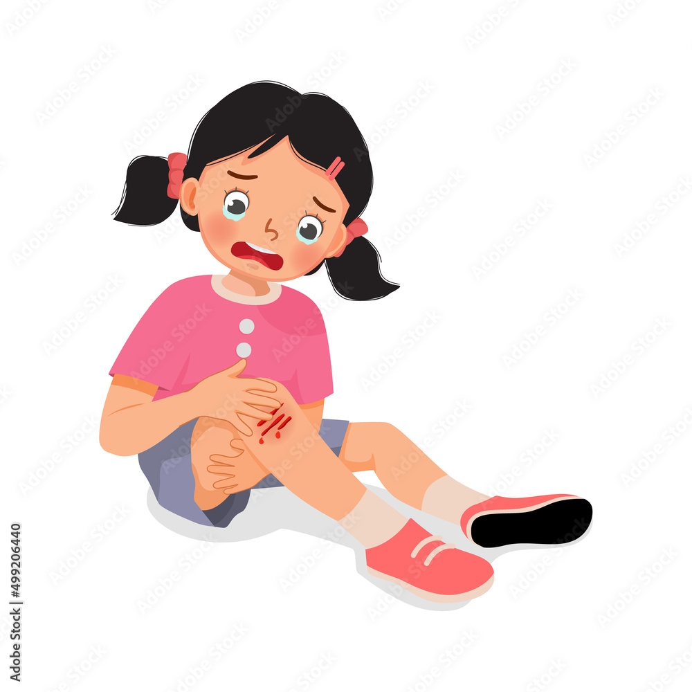 sad little girl has a knee injury crying holding her scratch bleeding leg with bruises after fell down